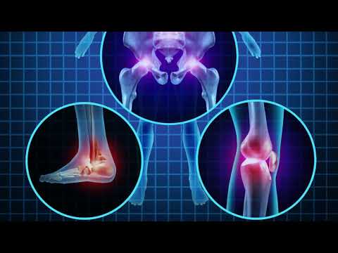 Revolutionizing Pain Management: Plant-Based Relief with SENDS Technology