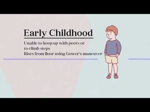 The Natural History of DMD Duchenne Muscular Dystrophy